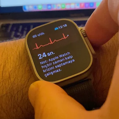 Akıllı saatlerle EKG çekimi