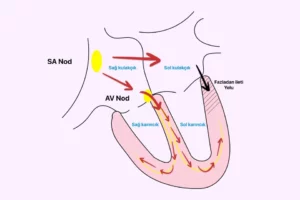 Wolff Parkinson White - WPW sendromu mekanizması