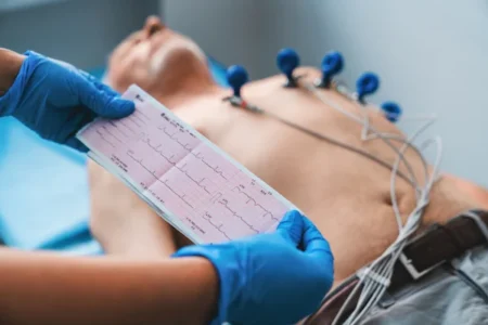 Elektrokardiyografi (EKG)