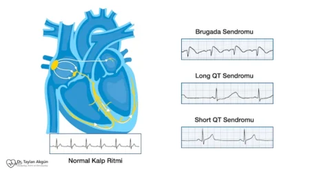 Elektriksel kalp hastalığı