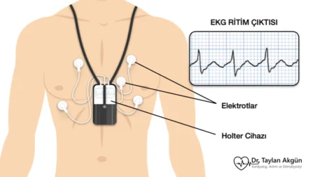 Holter, Holter cihazı veya Holter monitörü