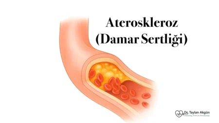 Ateroskleroz (Damar Sertliği)
