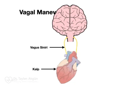 Vagal Manevra