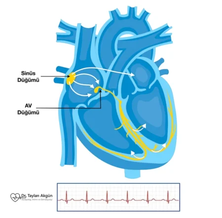 Kalp Krizi ve Kalp Ritim Bozuklukları